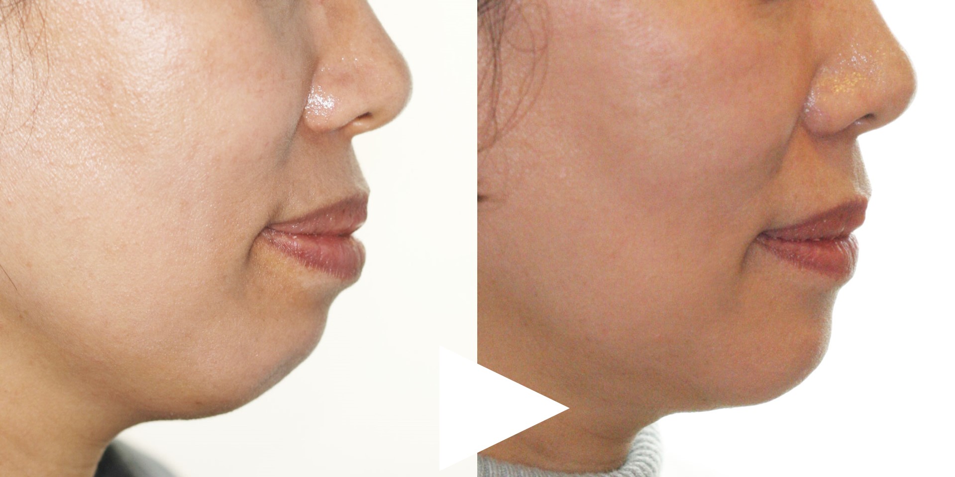 이미지를 불러올 수 없습니다.